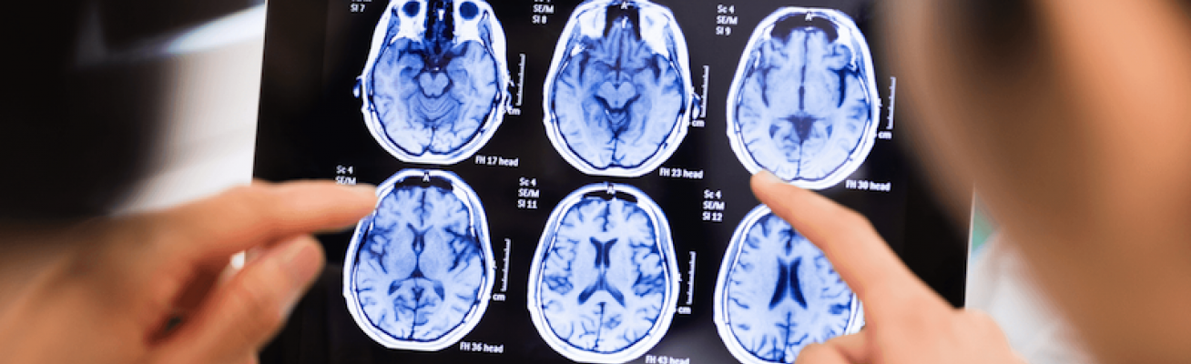 ipad with xray of brain